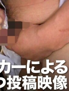 OTIM-264